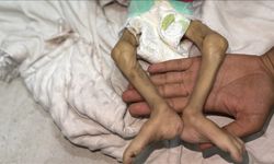 Gazze Şeridi'nde katliam devam ediyor! Son 24 saatte 1'i çocuk 14 Filistinli açlıktan hayatını kaybetti !