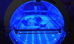 570 gram doğan Ayliz Nida 1 yaşına ulaştı