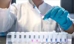 2024'te 1,3 milyon kişinin AIDS hastalığına yakalandı