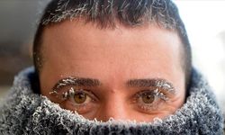 Soğuk havalarda göz sulanması neden olur?