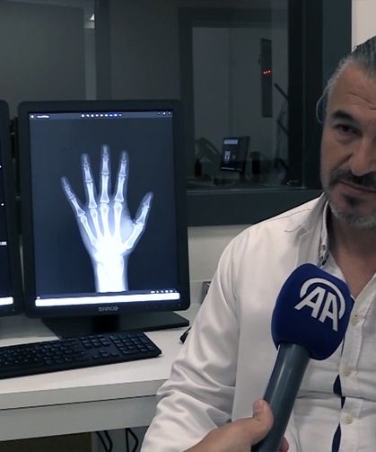 Sol el röntgeninden yüzde 96 doğrulukla kemik yaşı belirleyen yapay zeka sistemi geliştirildi