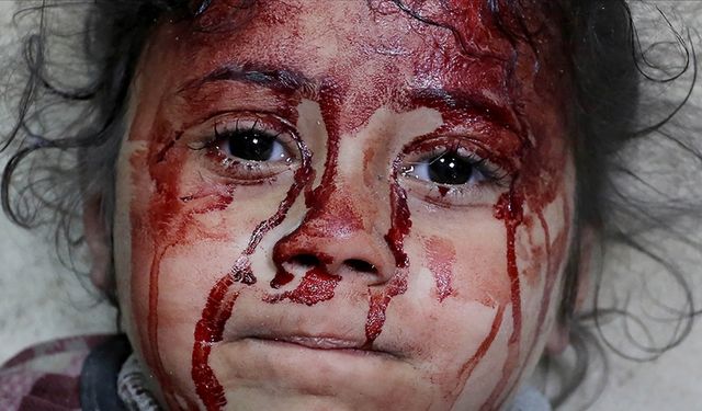 Gazze'de öldürülen çocuk sayısı, son 4 yılda savaşlarda ölen çocuk sayısından fazla !