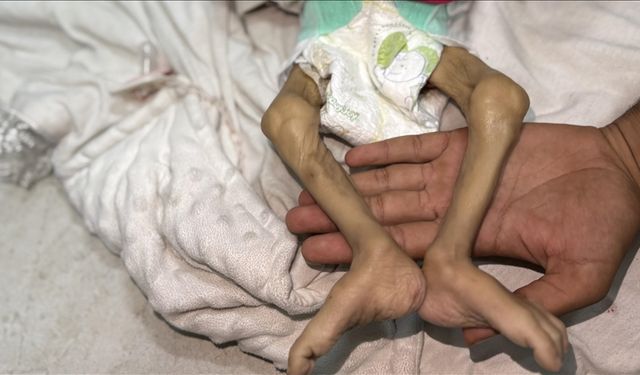 Gazze Şeridi'nde katliam devam ediyor! Son 24 saatte 1'i çocuk 14 Filistinli açlıktan hayatını kaybetti !