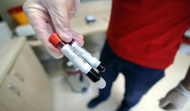 Uşak'ta kritik önem taşıyan o testler için başka illere gitmeye gerek kalmadı