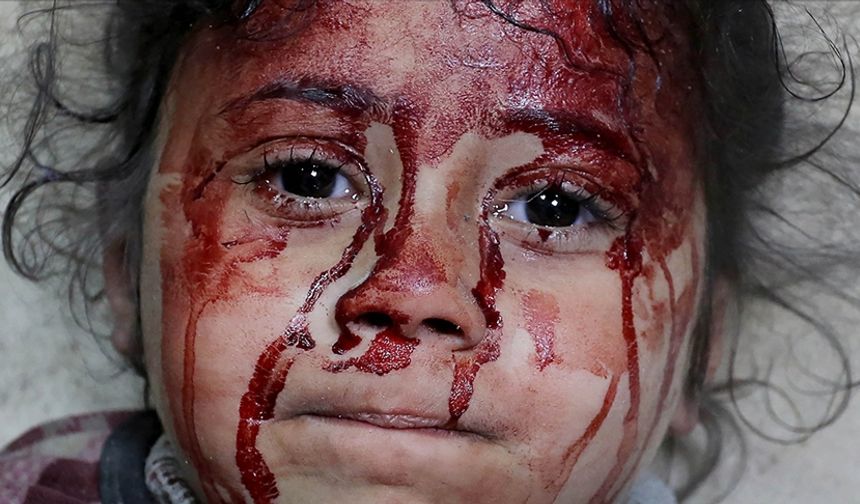 Gazze'de öldürülen çocuk sayısı, son 4 yılda savaşlarda ölen çocuk sayısından fazla !