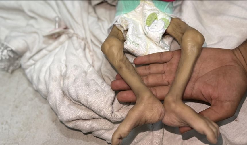 Gazze Şeridi'nde katliam devam ediyor! Son 24 saatte 1'i çocuk 14 Filistinli açlıktan hayatını kaybetti !