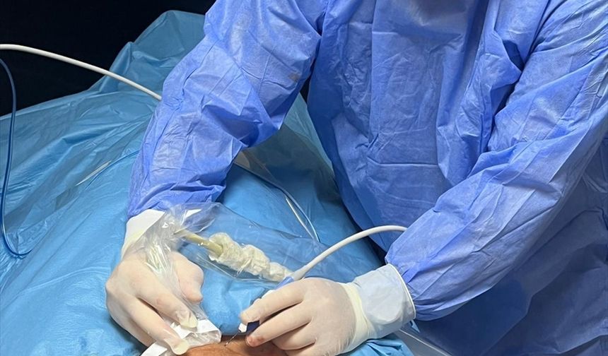 İzmirli hasta, devasa guatrına Kütahya Evliya Çelebi'deki girişimsel radyolojide çözüm buldu