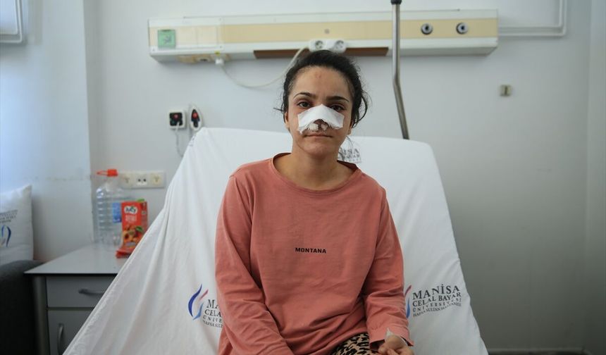 Turgutlu'da eşi tarafından burnu koparılan kadın yaşadıklarını anlattı