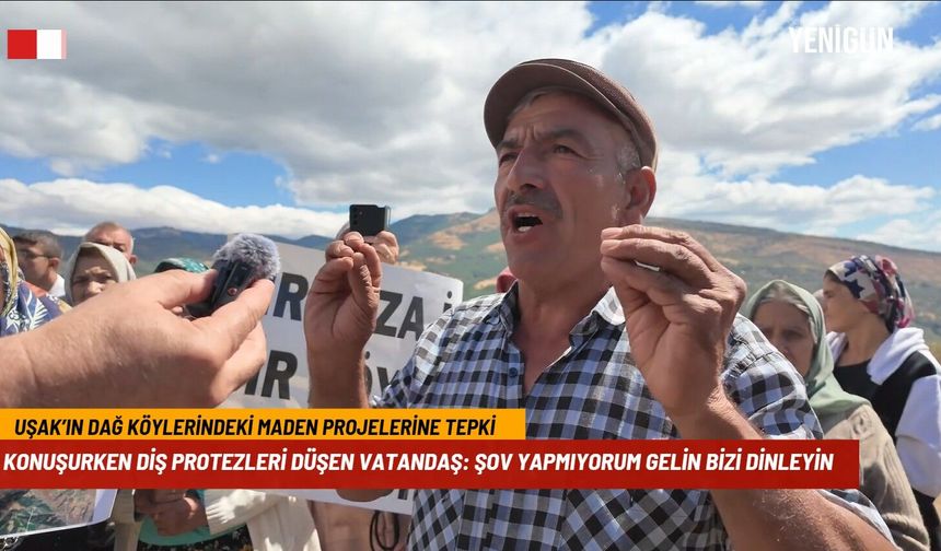 Konuşurken öfkelenince diş protezleri yerinden çıktı