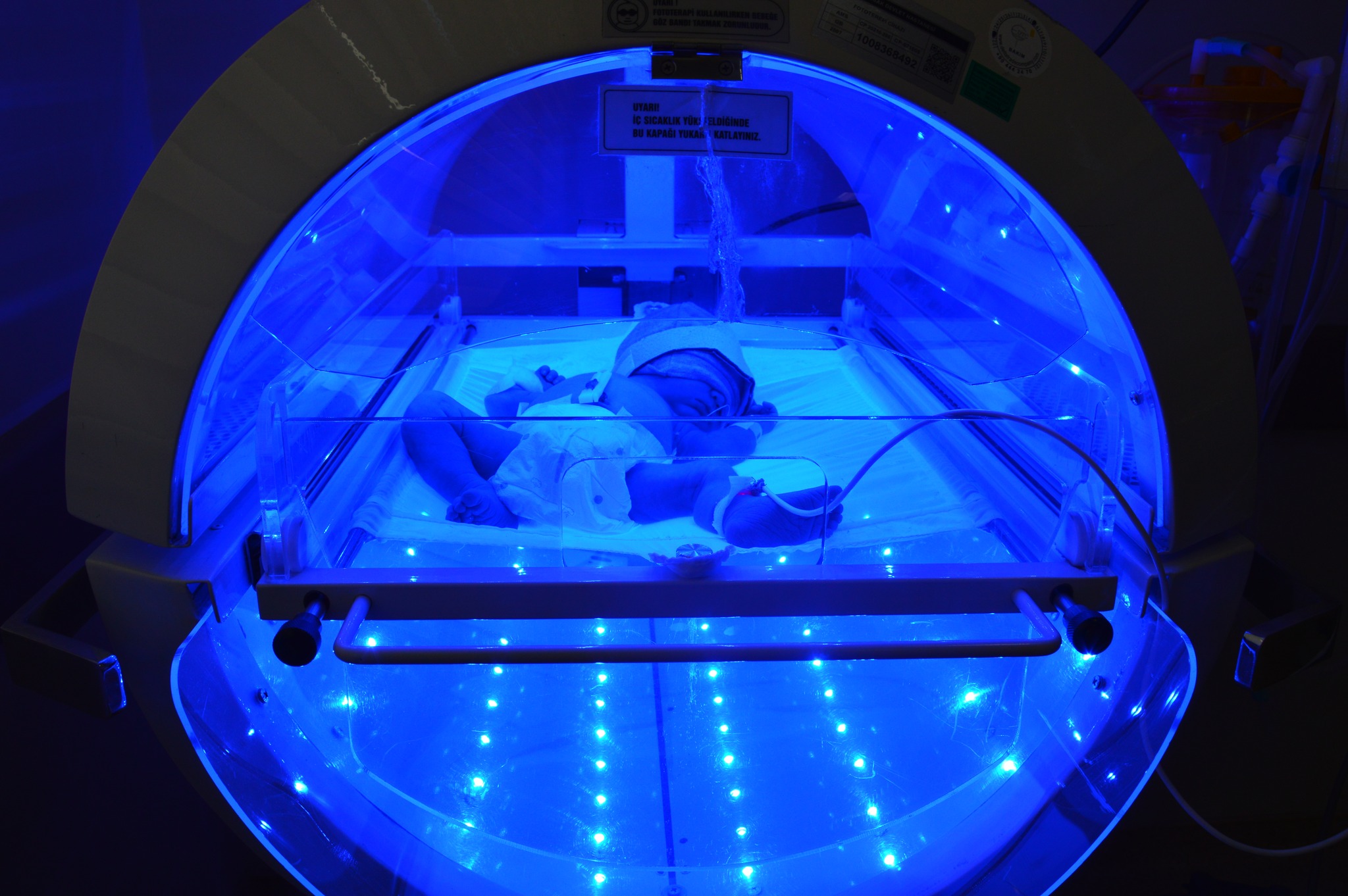 Prematüre Bebek (3)