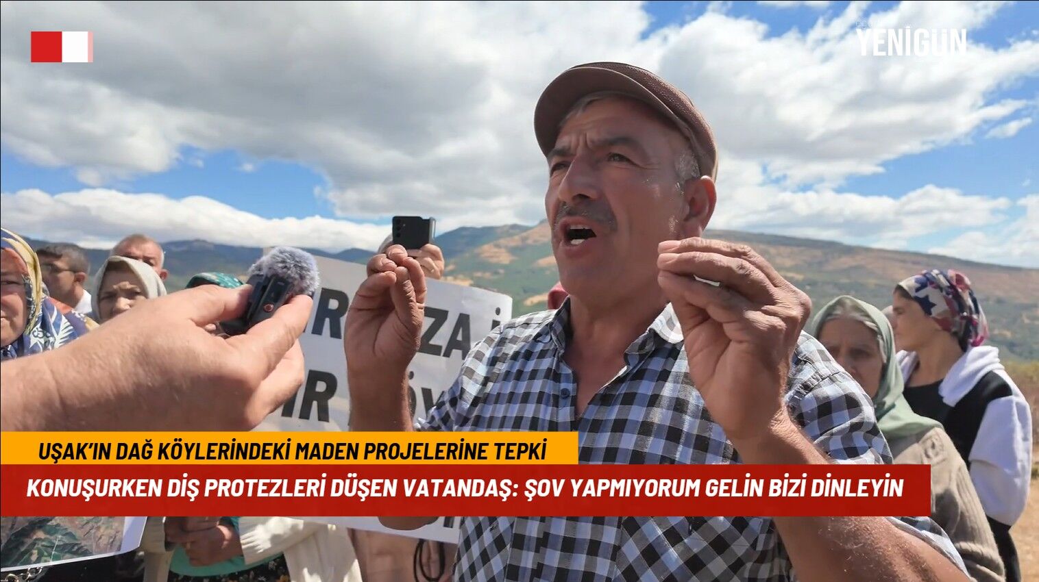 Konuşurken öfkelenince diş protezleri yerinden çıktı